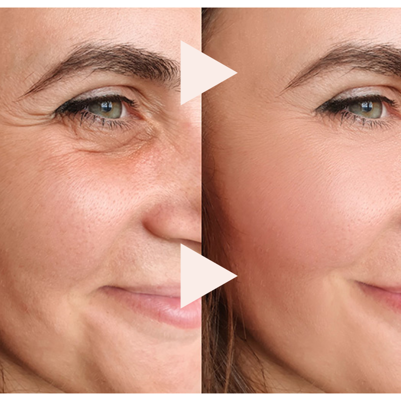 ✨LAST DAY SALE 60% OFF✨The Express "Instant Facelift" – Smooths Wrinkles in Seconds!（50%）