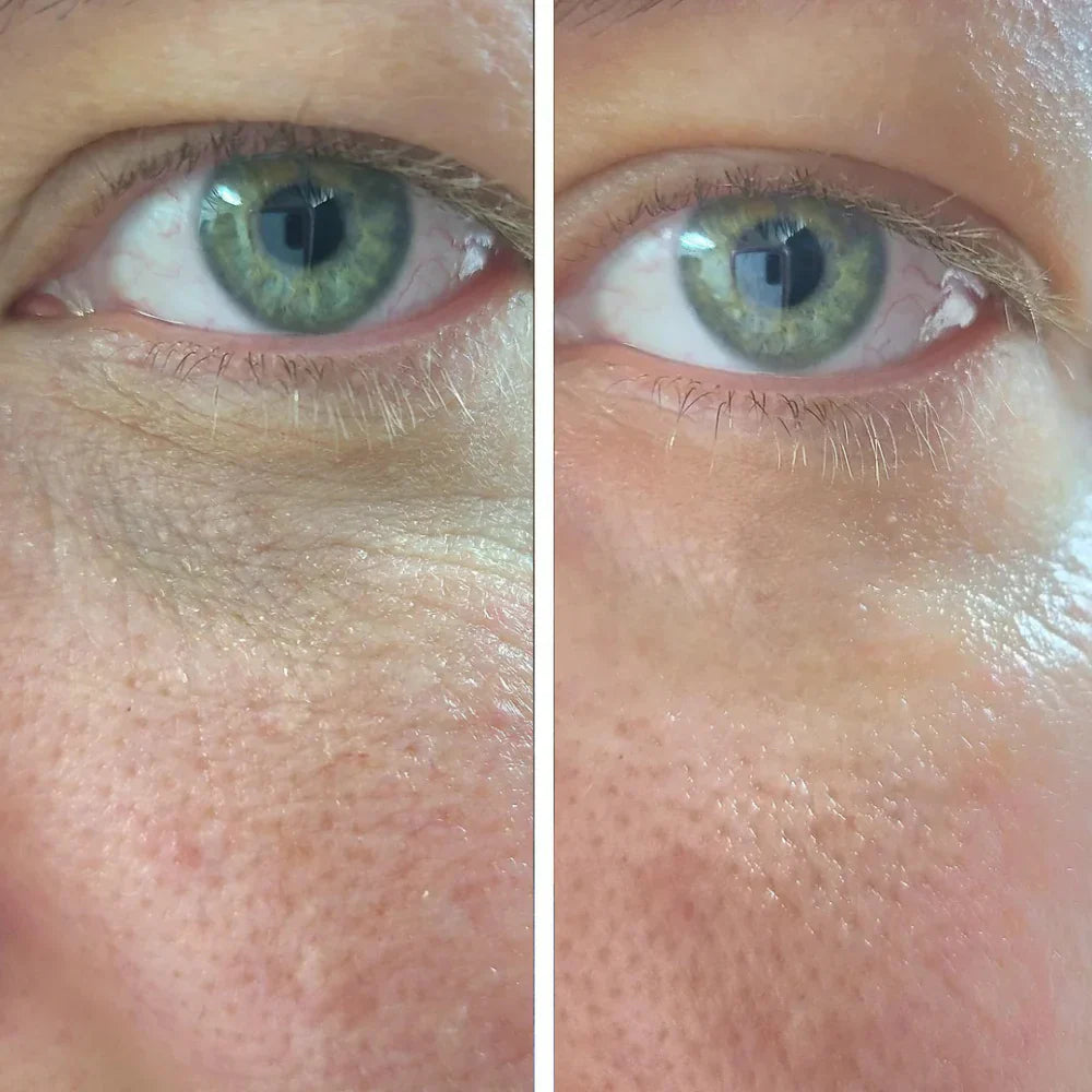 Customer under-eye result comparison