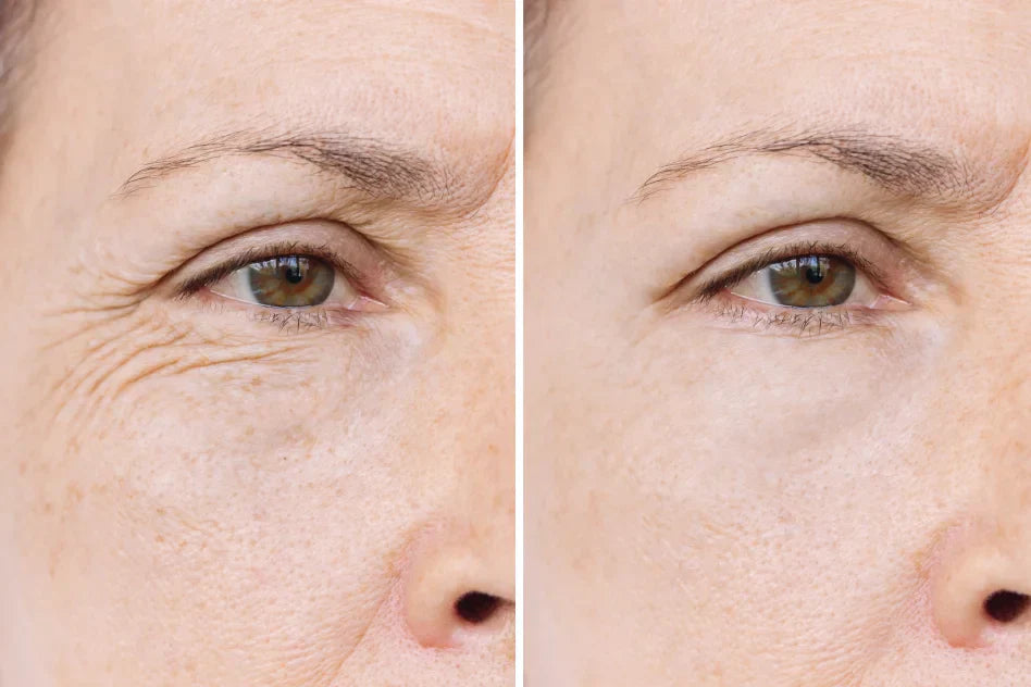 Customer eye-area result comparison